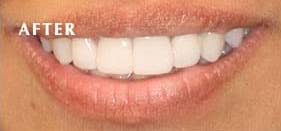 After Photo